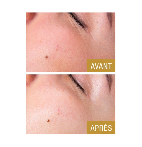 Soin Instant Beauty